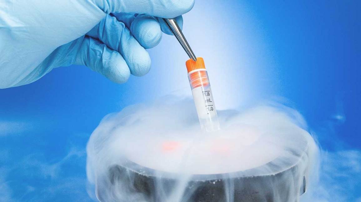 Cryopreservation